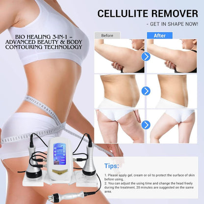 40K Cavitation & RF Fat Reduction Machine