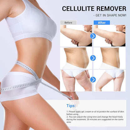 40K Cavitation & RF Fat Reduction Machine