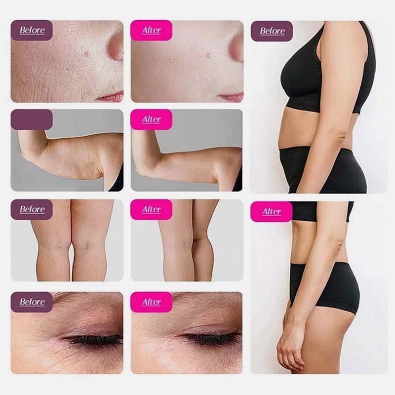 9-in-1 Ultrasonic Cavitation & RF Body Contouring Beauty Machine (80K Technology)