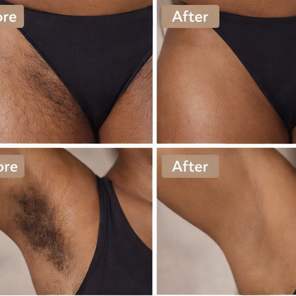 IPL Laser Facial & Whole Body Hair Removal Handset