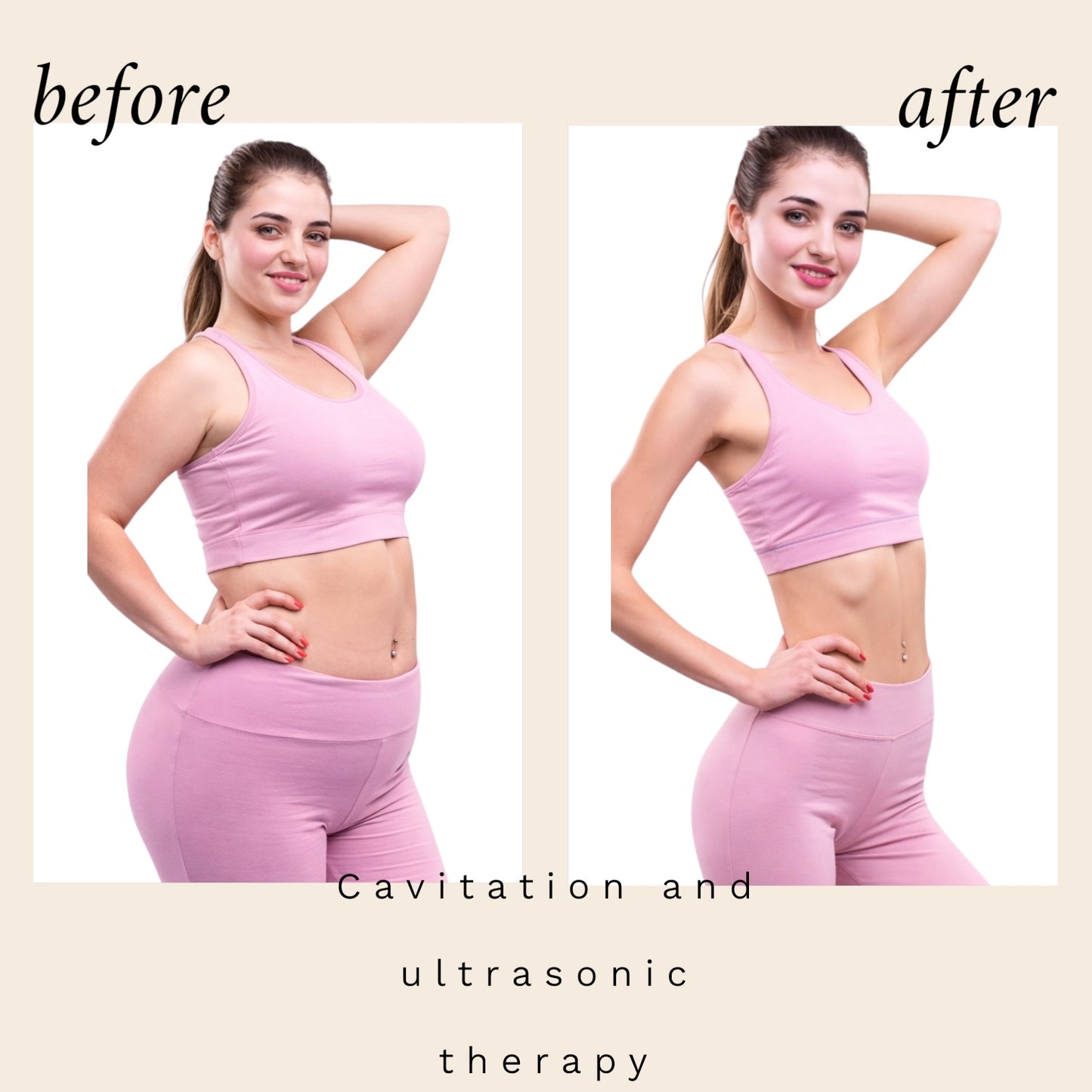6-in-1 Ultrasonic Cavitation + RF Machine