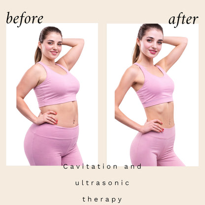 6-in-1 Ultrasonic Cavitation + RF Machine
