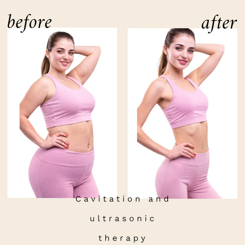 6-in-1 Ultrasonic Cavitation + RF Machine