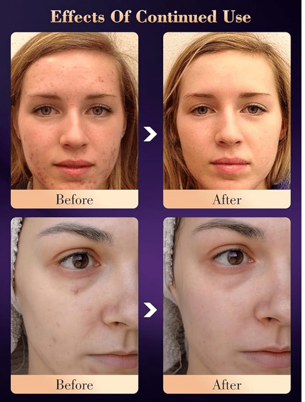 LED Hydrating light therapy mask